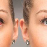 Seasonal eye allergies