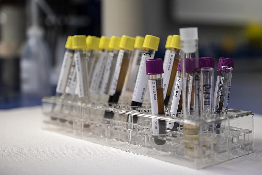 Diagnostics -tests -allergy tension fatigue syndrome