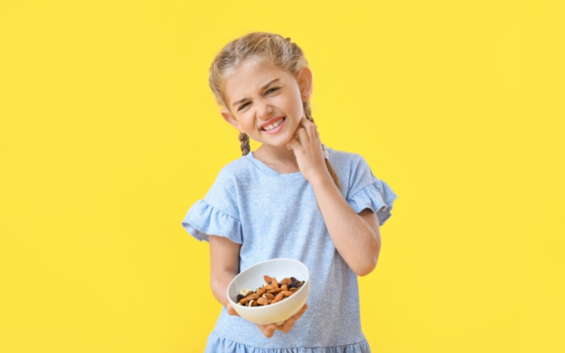 Food Allergies