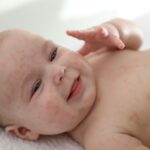Skin Rashes in Babies